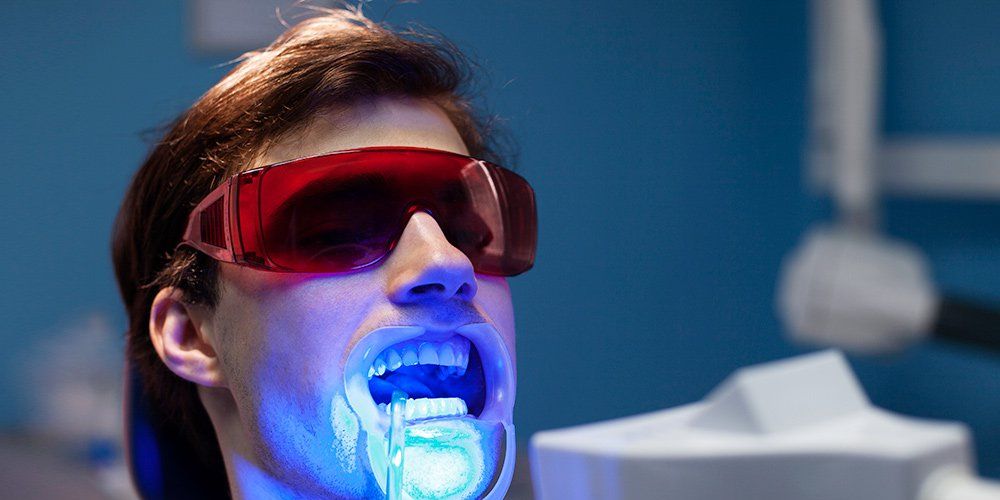 Factors to Consider when Buying a  Teeth Whitening Kit Online